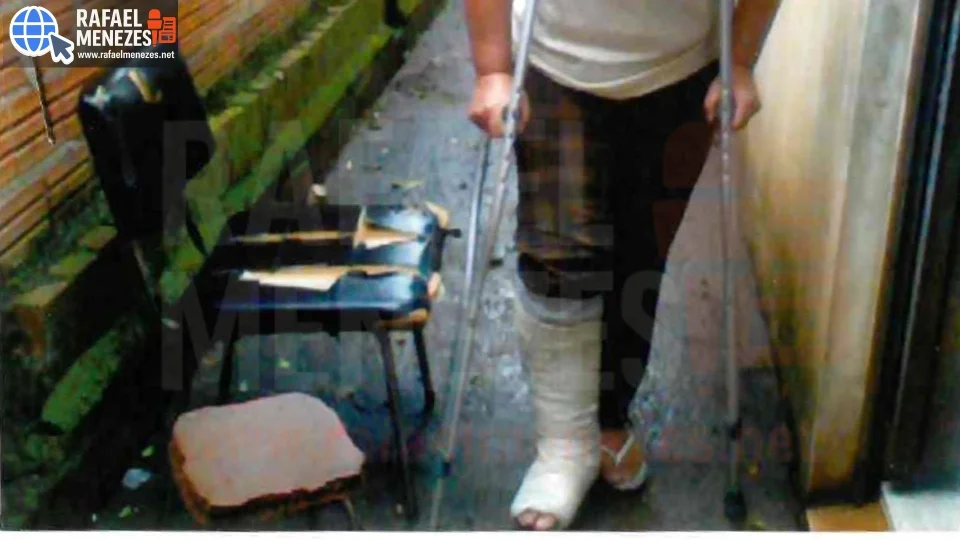 Município de Santa Maria é condenado a indenizar mulher que fraturou o pé em calçada