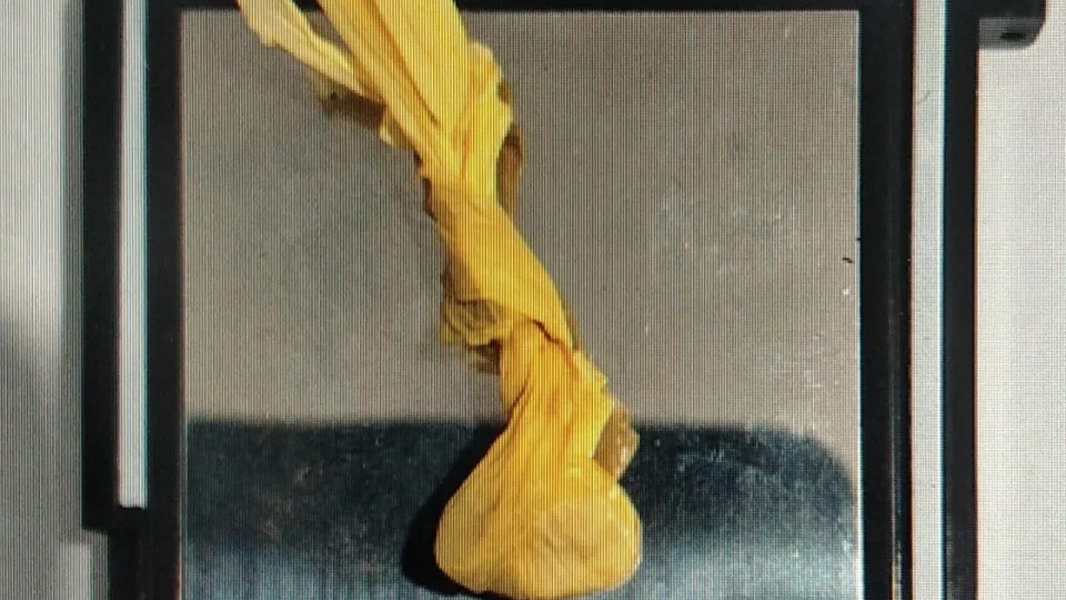 Dois jovens são flagrados com drogas durante abordagem em Agudo